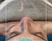institut & spa éveil des sens oudon - institut de beauté spa JETPEEL ANTI RIDES alternative botox - 25.10.2023