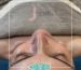 institut & spa éveil des sens oudon - institut de beauté spa JETPEEL ANTI RIDES alternative botox - 25.10.2023